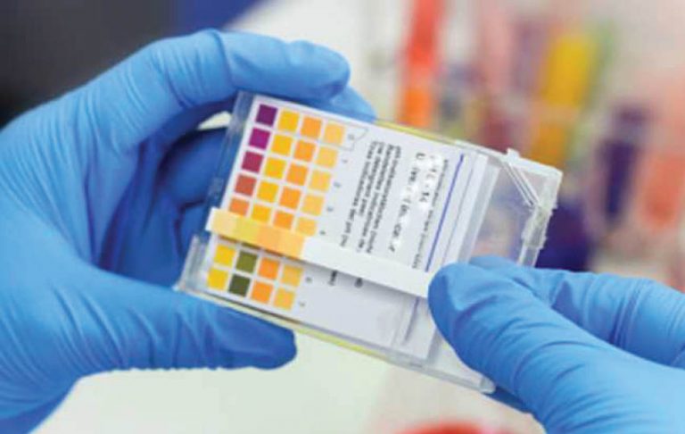 Tata Group To Launch ‘Feluda’ – India’s First Low Cost Covid-19 Test